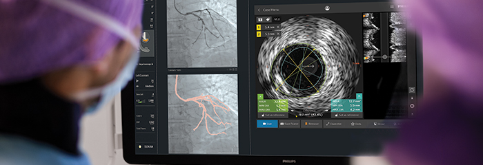 Finestra a comparsa trattamento cad intrasight