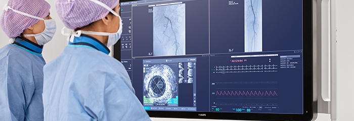 Finestra a comparsa trattamento cad ivus
