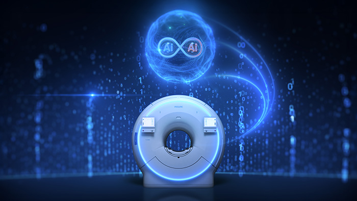 Philips Advances MRI Speed and Precision with FDA 510(k) Clearance of SmartSpeed Precise Dual AI Software